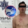 Hombre detenido por atropellar intencionalmente a una mujer tras una discusión