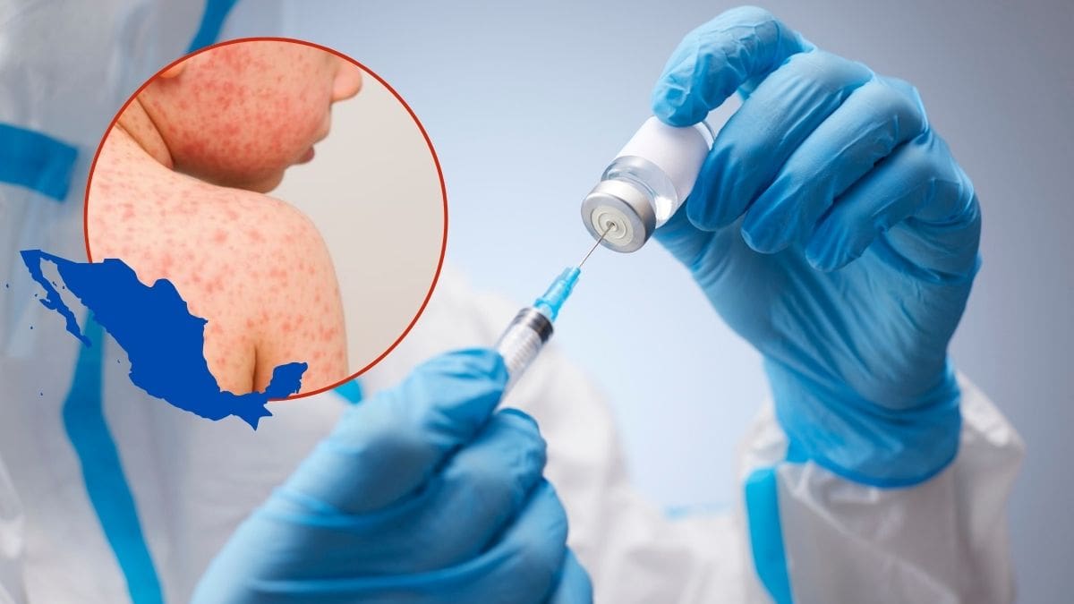 Sonora mantiene cero muertes por sarampión en 2026 pese a ser el sexto estado con más casos confirmados; continúa vacunación masiva y vigilancia epidemiológica