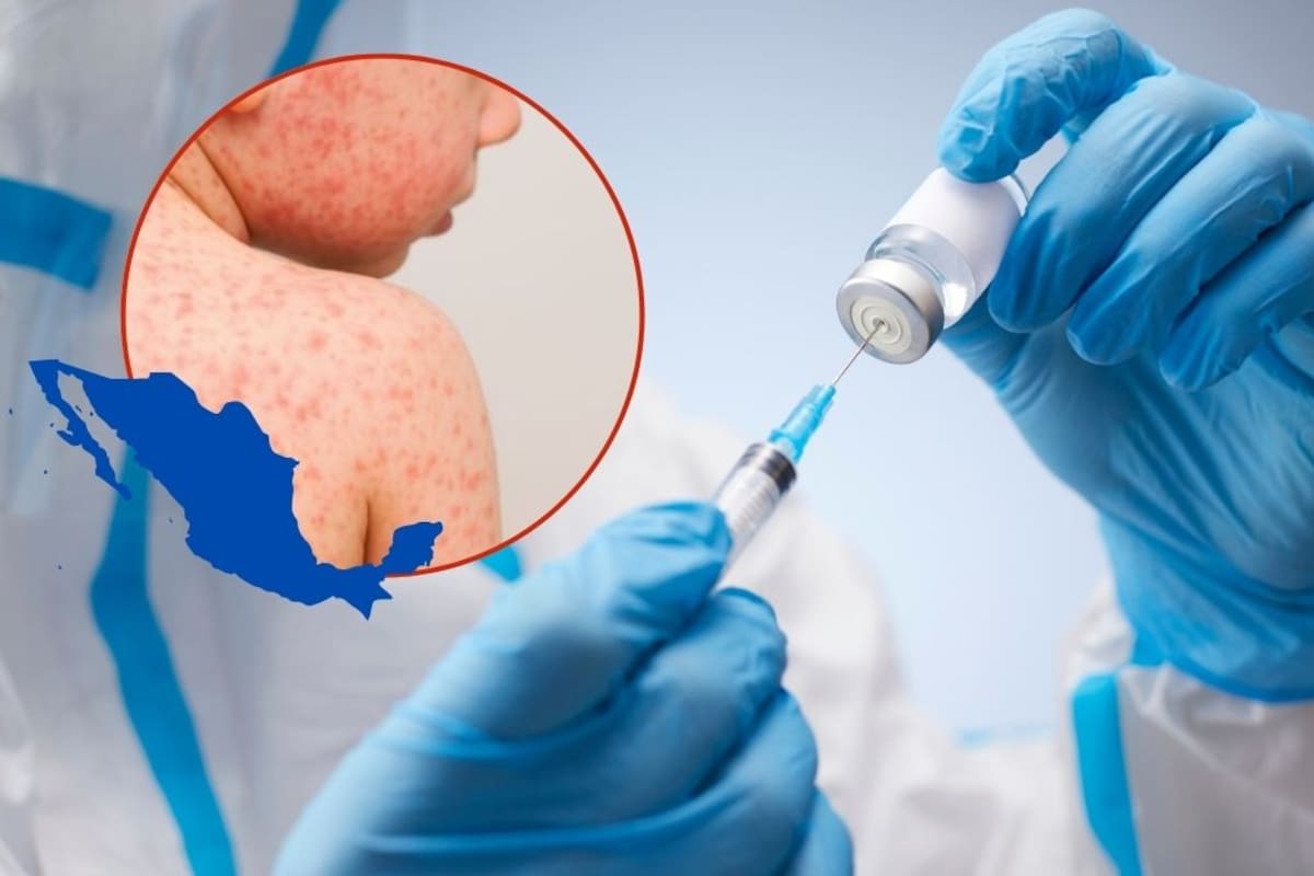 El brote de sarampión en México suma 9,478 casos confirmados y 29 muertes; Sonora acumula 53 casos