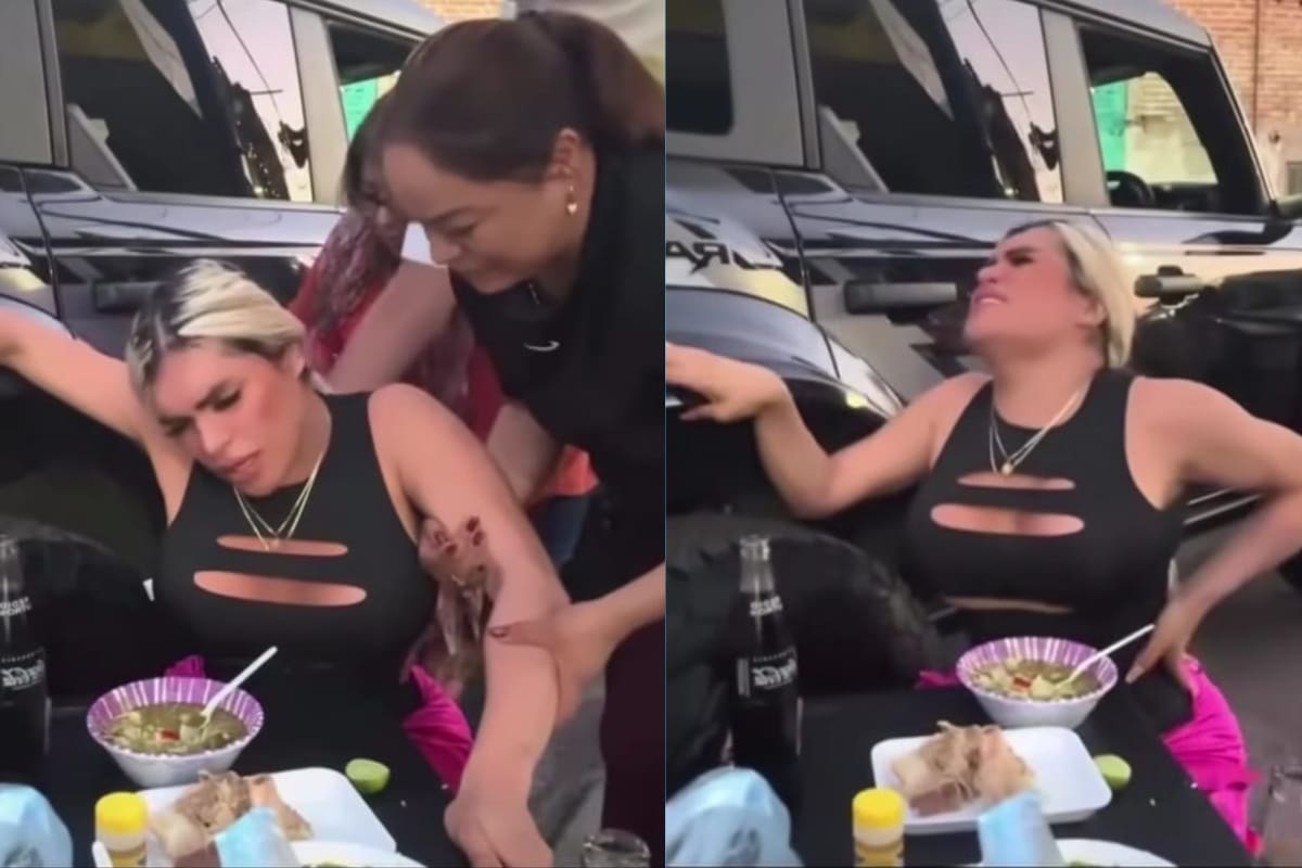 Wendy Guevara se desvanece en vivo por dolor tras estornudar; estas son las complicaciones que ha tenido tras operarse las costillas (VIDEO)