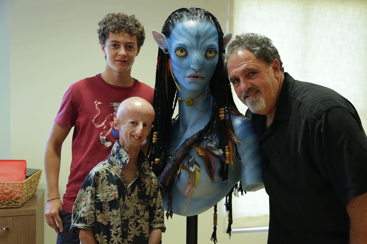 Nacido en 1995 en Schio (norte), con dos años le diagnosticaron la progeria de Hutchinson-Gilford. Foto: Sammy Basso