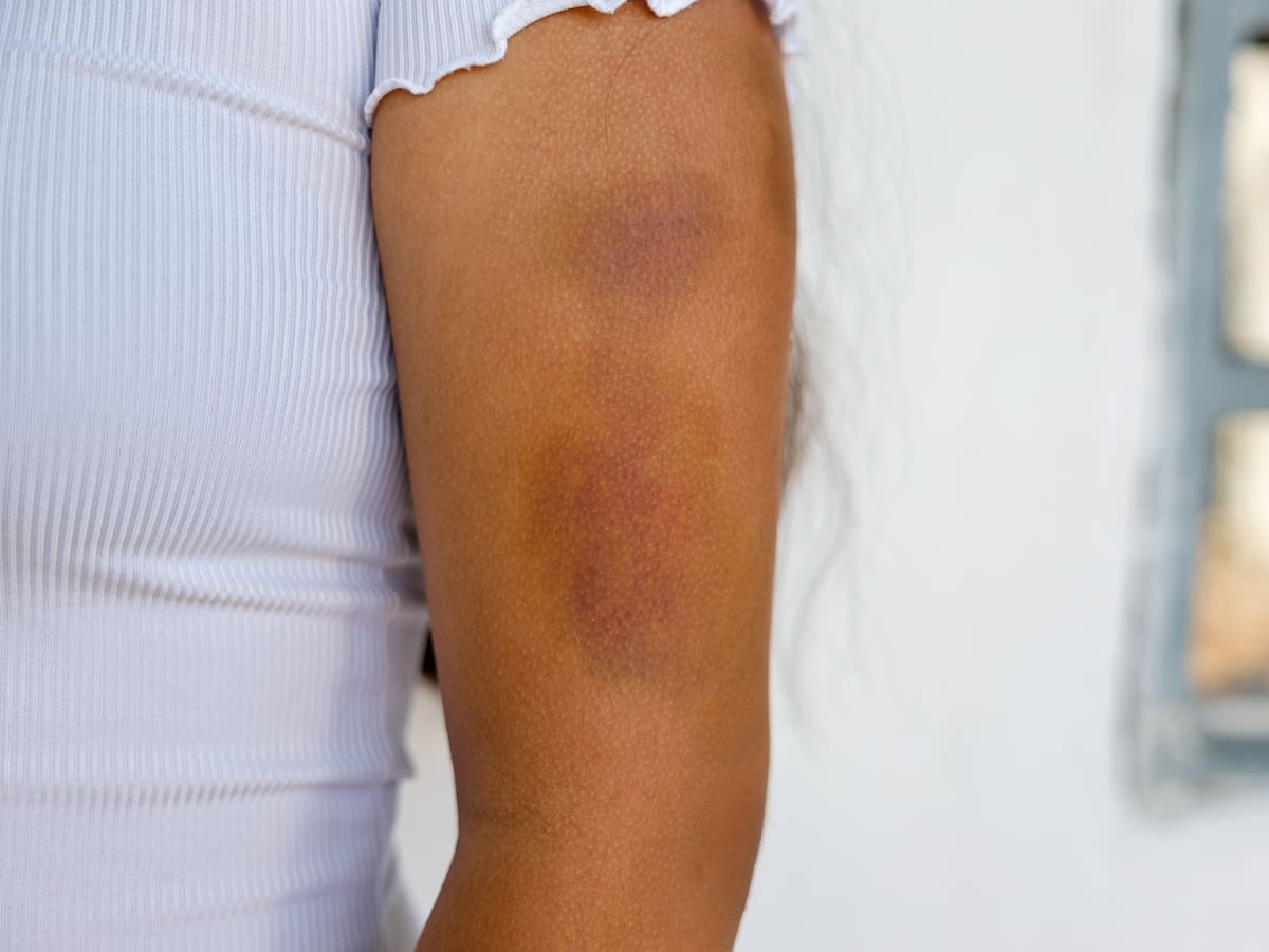 Foto: Juan J.Morales