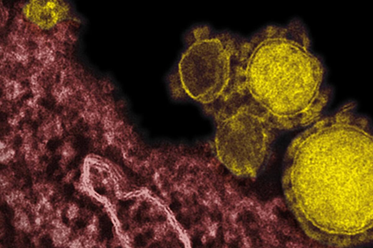 Los virus más letales del mundo