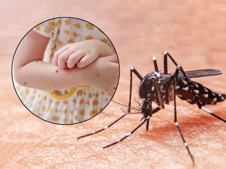 Sonora acumula por dengue 5 muertes y más de 4 mil casos, el doble de los contagios registrados en los últimos tres años