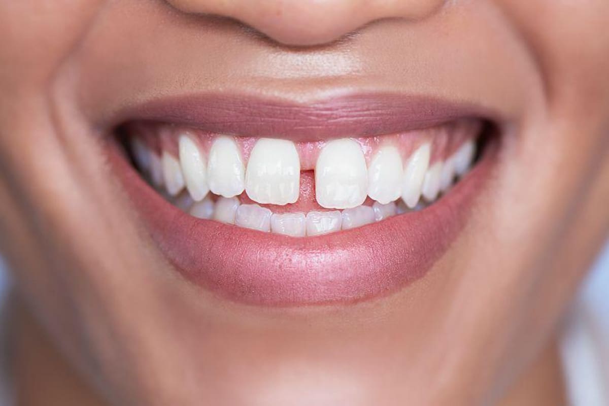 Cuáles son los beneficios de renunciar a ser excepcional y aceptar ser común y corriente