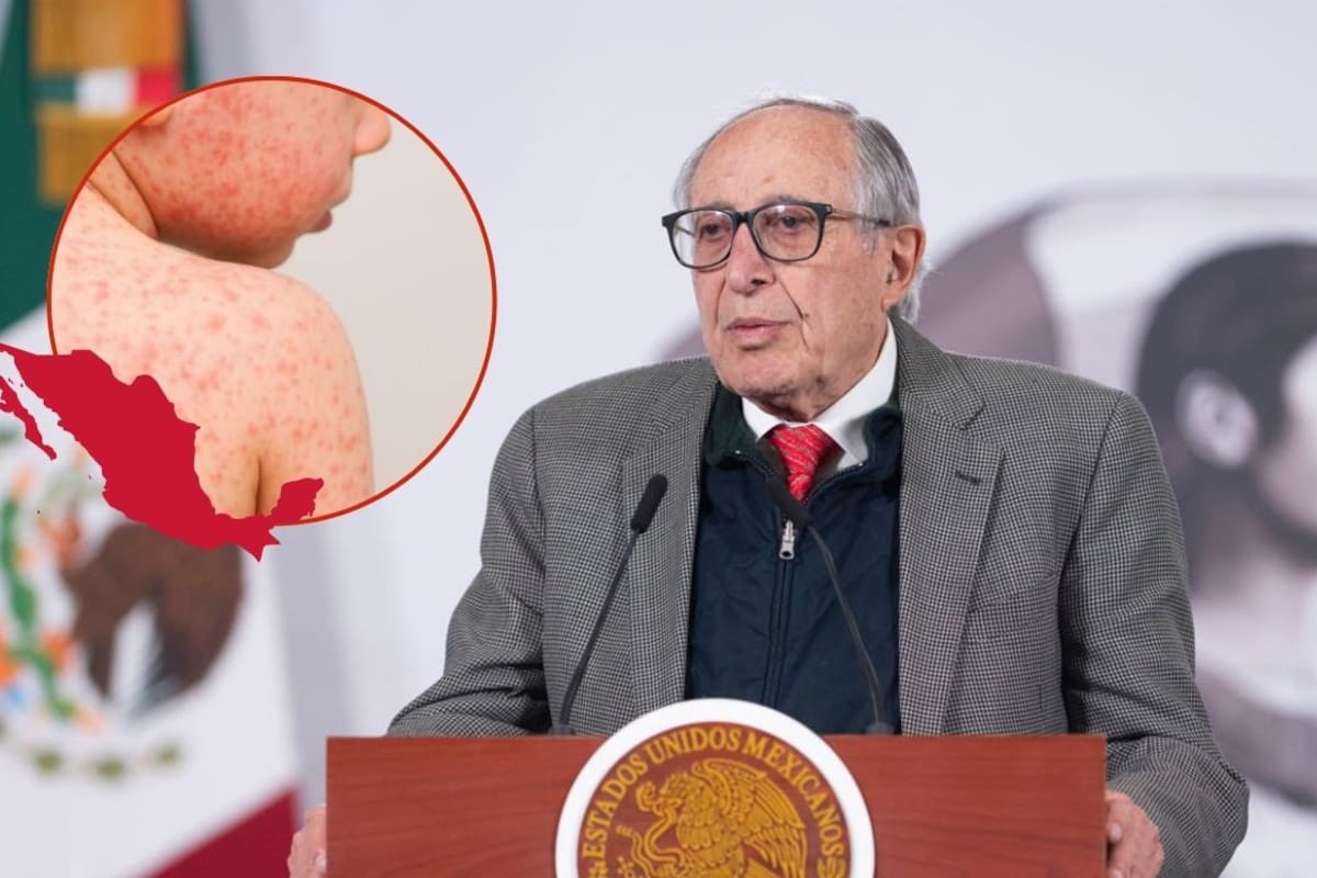 David Kershenobich, secretario de Salud alerta por brotes de sarampión en siete estados y refuerza vacunación: Jalisco, CDMX, Chiapas y Sinaloa entre los más afectados