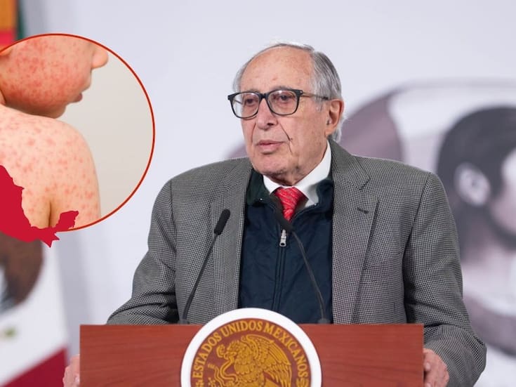 David Kershenobich, secretario de Salud alerta por brotes de sarampión en siete estados y refuerza vacunación: Jalisco, CDMX, Chiapas y Sinaloa entre los más afectados