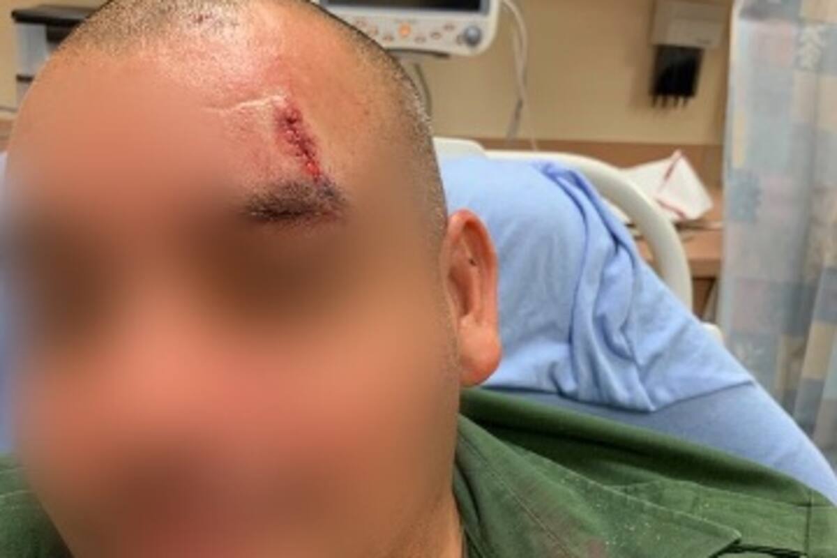 Atacan a un agente de la Patrulla Fronteriza en Calexico