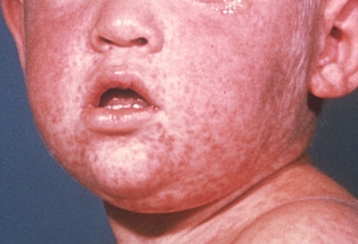 En Estados Unidos, los estados tienen la facultad de exigir vacunas para la asistencia escolar, lo que genera diferencias en las políticas entre entidades. Foto: Cortesía