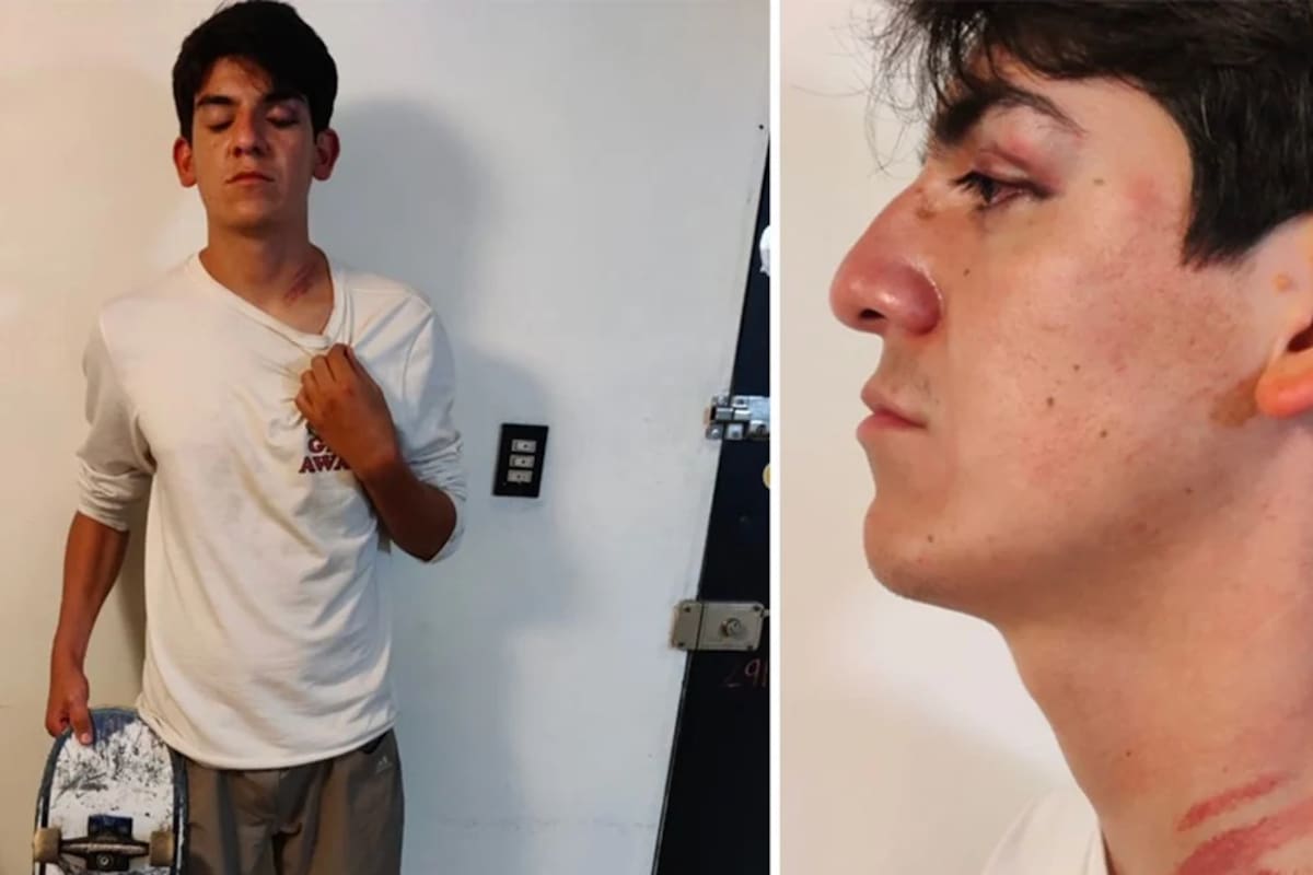 Skaters sufren golpiza de policías por patinar en parque de Hidalgo cerrado por Covid