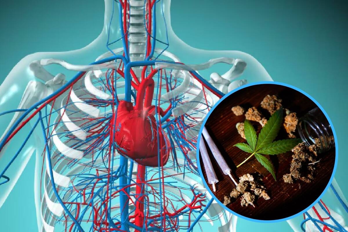 Consumo de marihuana se asocia con el desarrollo de insuficiencia cardiaca según estudios