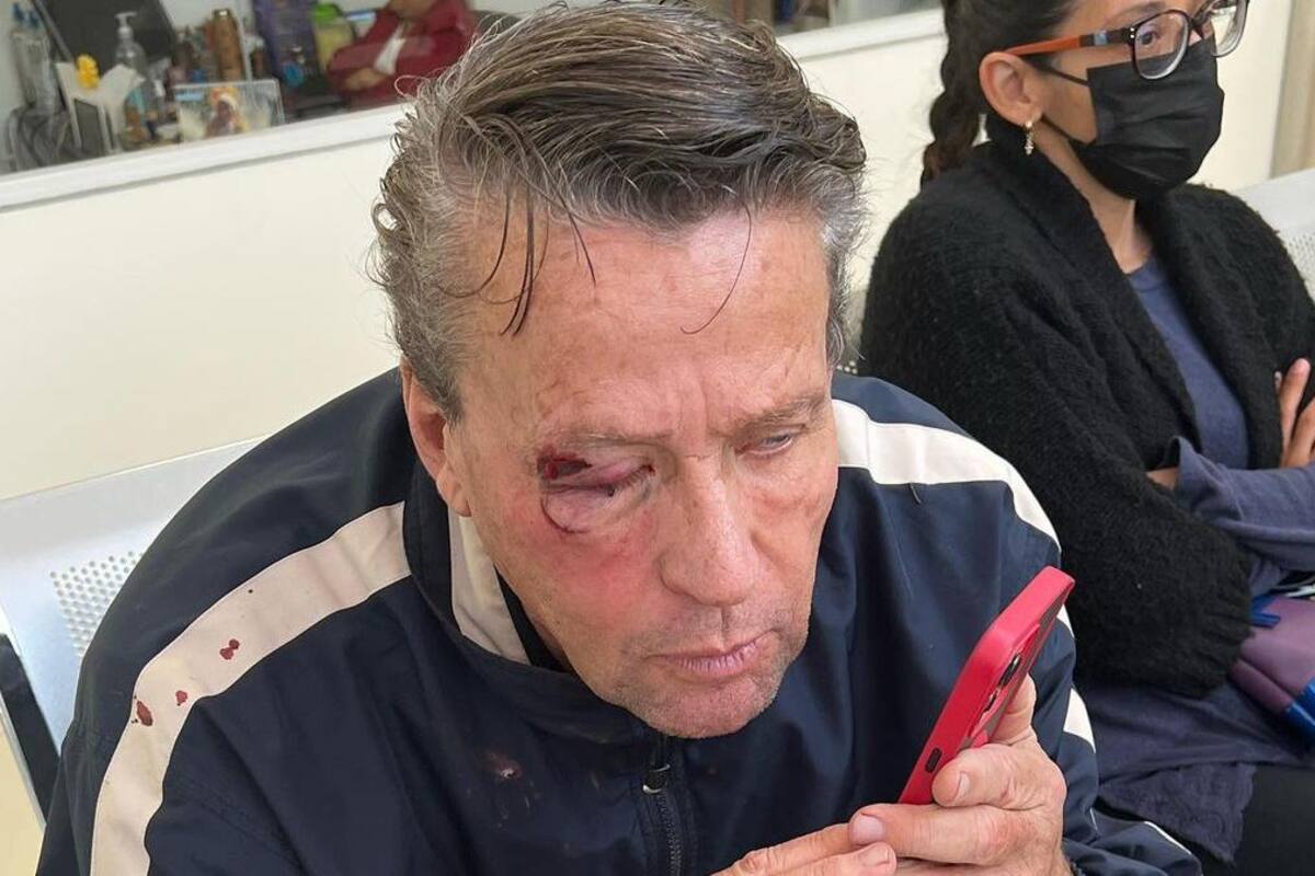 Alfredo Adame fue golpeado fuera de su casa