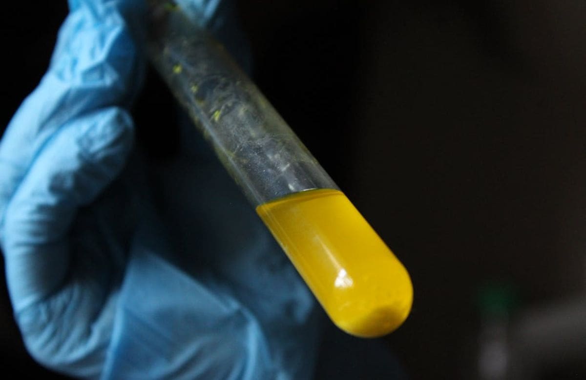 Olores inusuales en la orina pueden indicar infecciones urinarias o alteraciones metabólicas, advierten especialistas | Foto: Especial (canva)