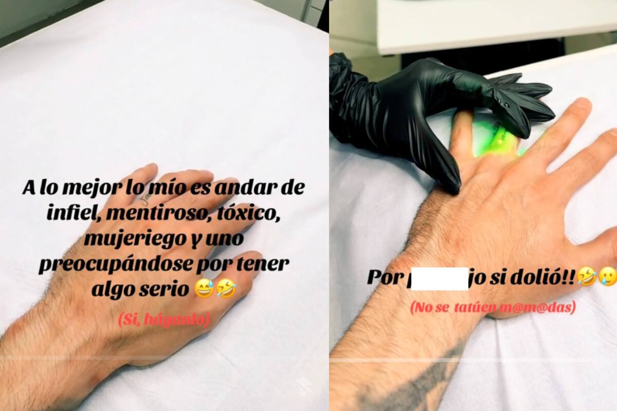 Hombre se quita el tatuaje de su expareja sin anestesia como castigo para “aprender la lección”