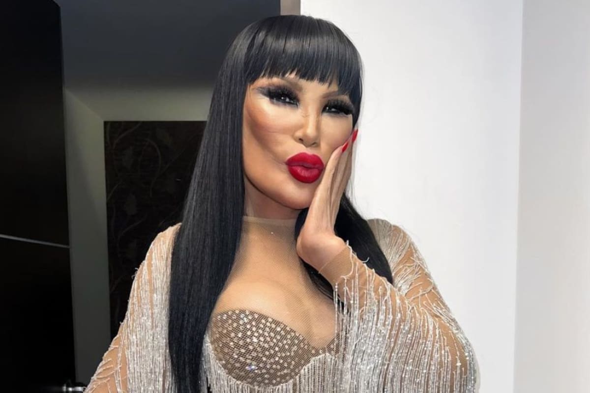 Lyn May planea visitar a un doctor en Los Angeles para arreglar su rostro