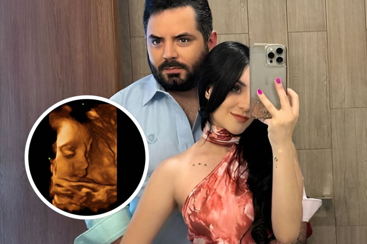José Eduardo Derbez y Paola Dalay revelan primeras imágenes del ultrasonido de su bebé