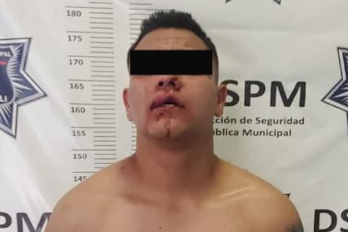 Descubre a hombre forzando el cerco de su casa y es golpeado brutalmente