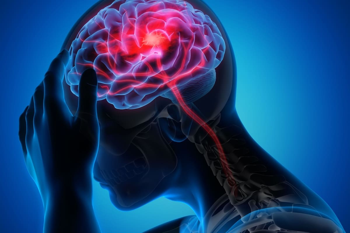 Si sufres de migraña, evita consumir estos cinco alimentos