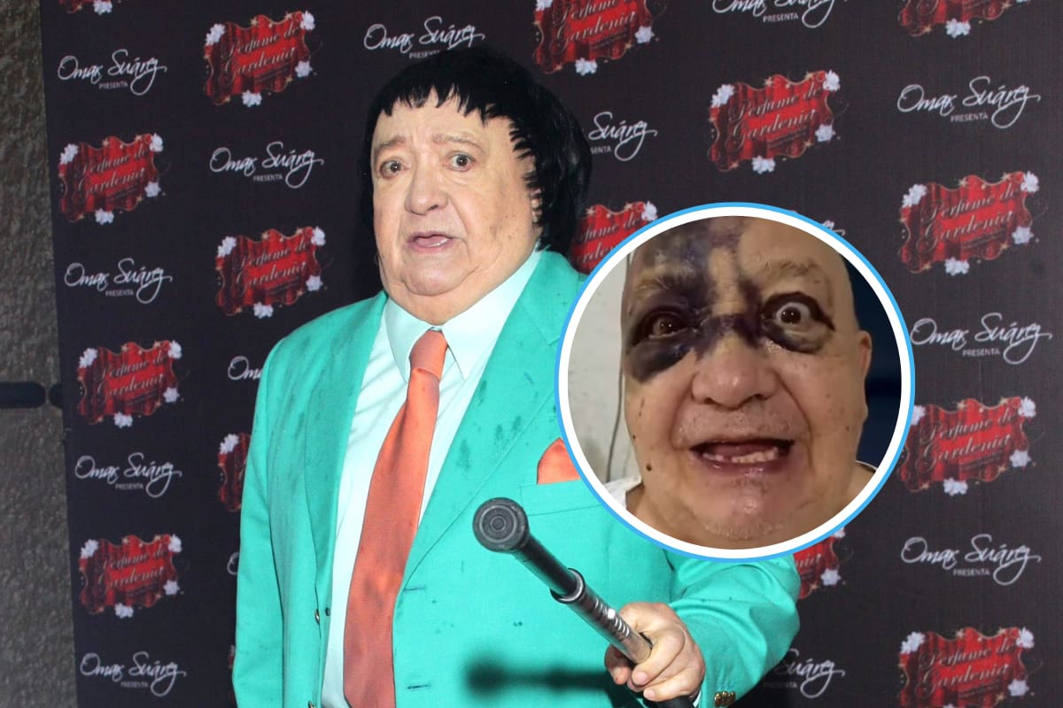 ¿Qué le pasó a Luis de Alba? Su esposa revela la verdadera causa del golpe en su rostro
