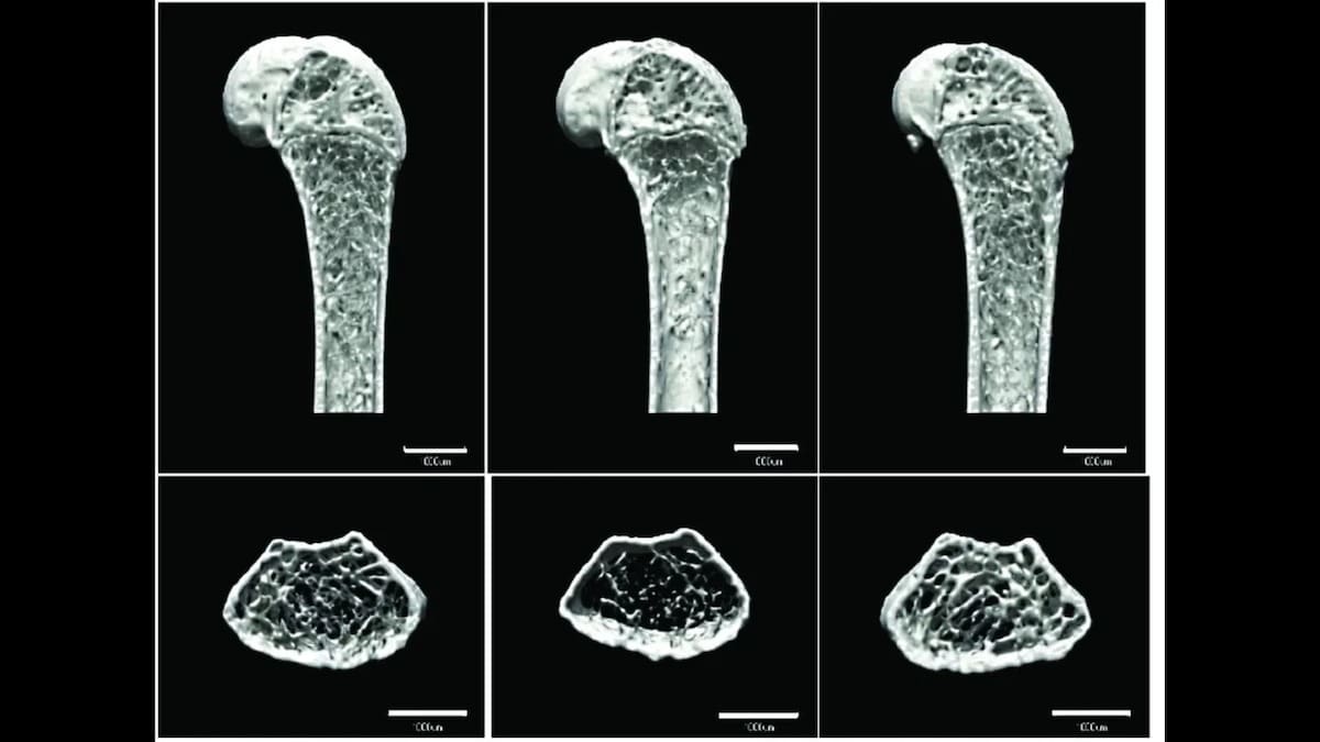 Esta imagen muestra la pérdida de densidad ósea por microgravedad en el espacio. Foto: NASA