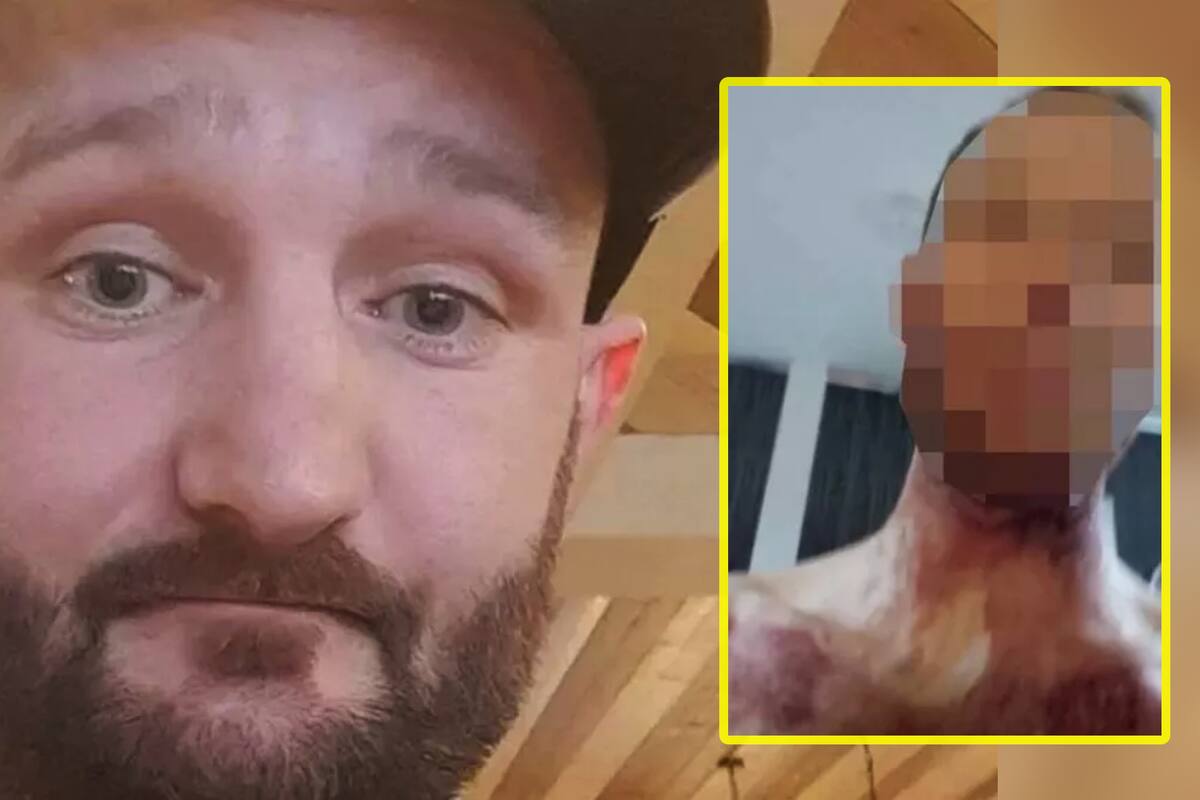Hombre es torturado hasta la muerte en videos publicados en Snapchat; el atacante, manchado de sangre, compartió una selfie
