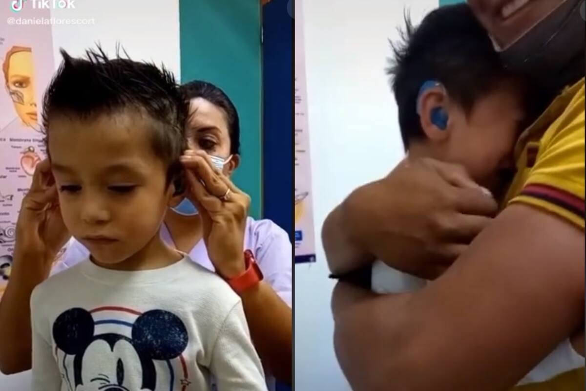 VIRAL: Niño llora al poder escuchar por primera vez a sus padres con ayuda de aparatos auditivos