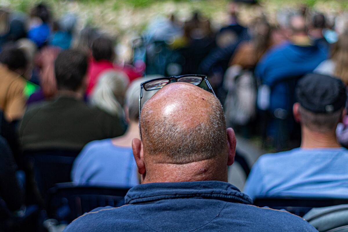 Hombres con calvicie podrían ser propensos a contraer Covid-19