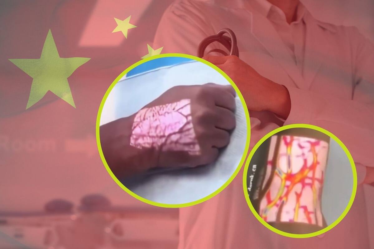 ¿Se puede ver la sangre sin cortar la piel? Este dispositivo difundido por la Embajada de China en México muestra las venas subcutáneas en tiempo real (VIDEO)