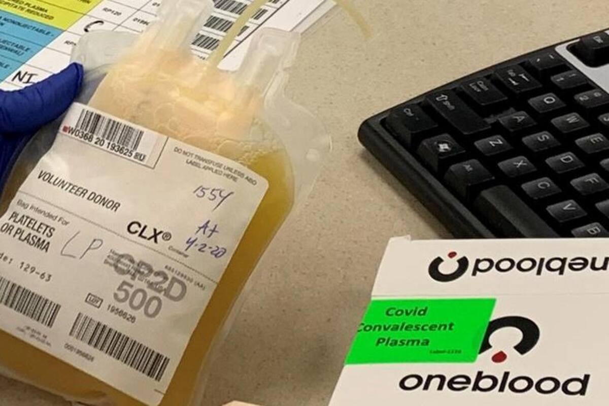 Hospital alemán elabora plasma terapéutico para tratar COVID-19