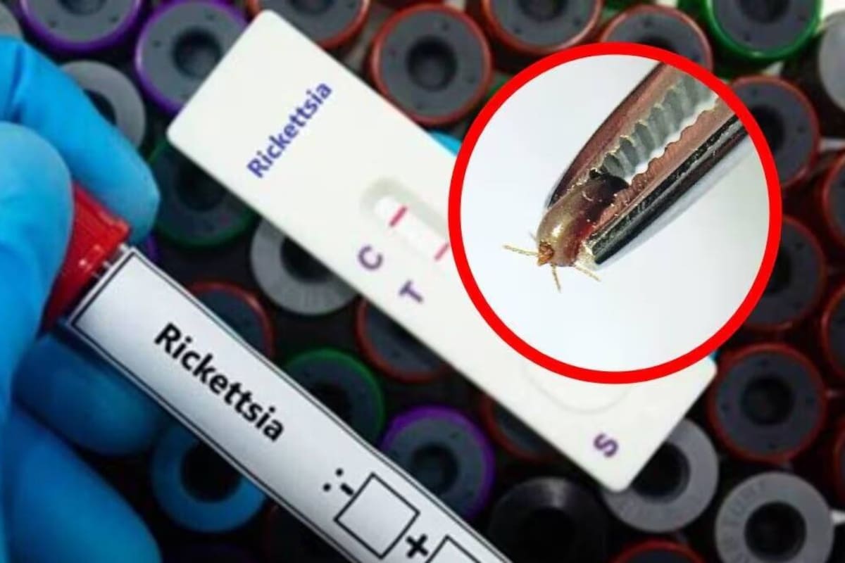Refuerzan prevención en escuelas ante 120 casos de rickettsia en Baja California