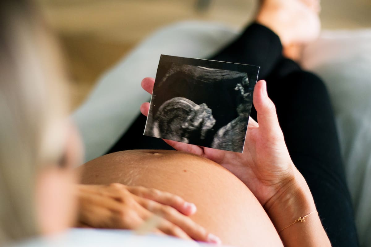 Dos de cada tres mujeres podrían reducir riesgo de defectos congénitos en sus bebés, revela estudio