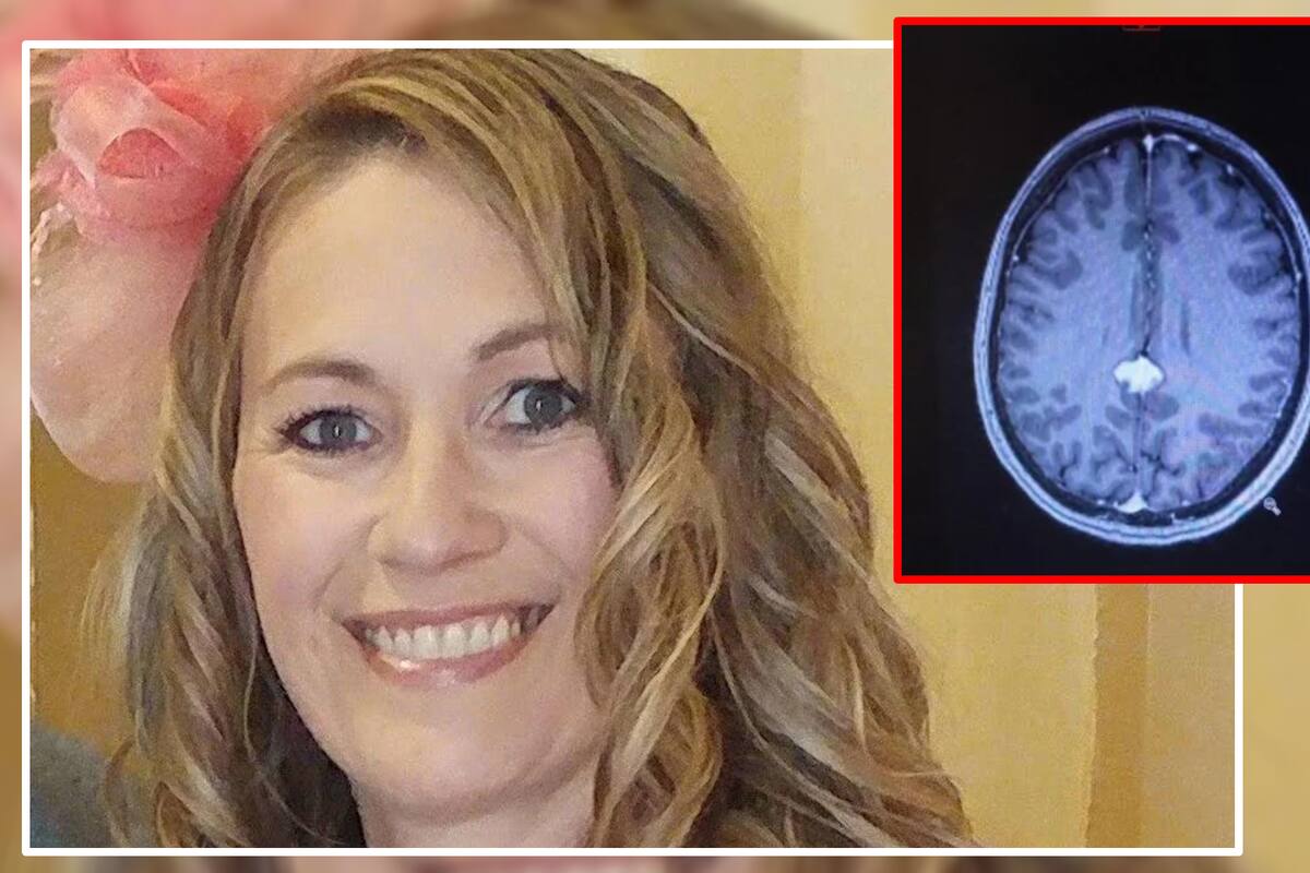 Mujer culpaba a la menopausia por sus olvidos, pero su doctor descubre que tenía un tumor en el cerebro
