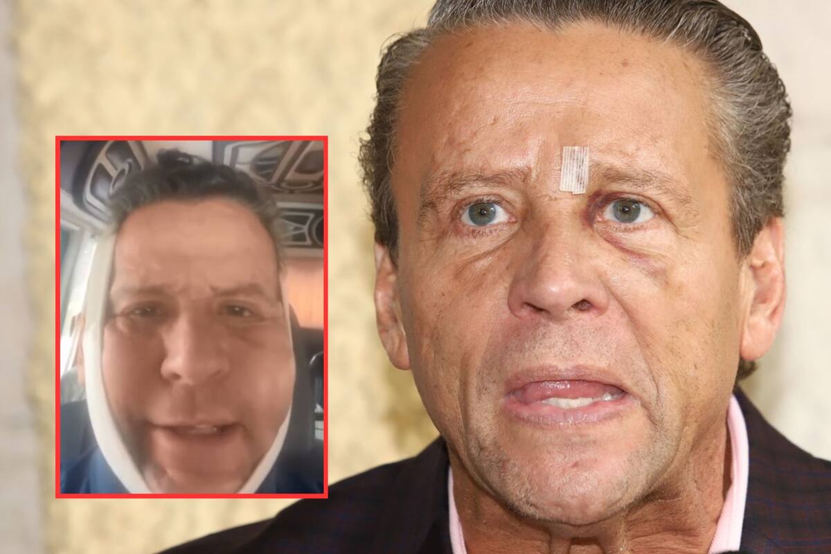 ¿Qué le pasó? Alfredo Adame causa preocupación por aparecer con el rostro inflamado