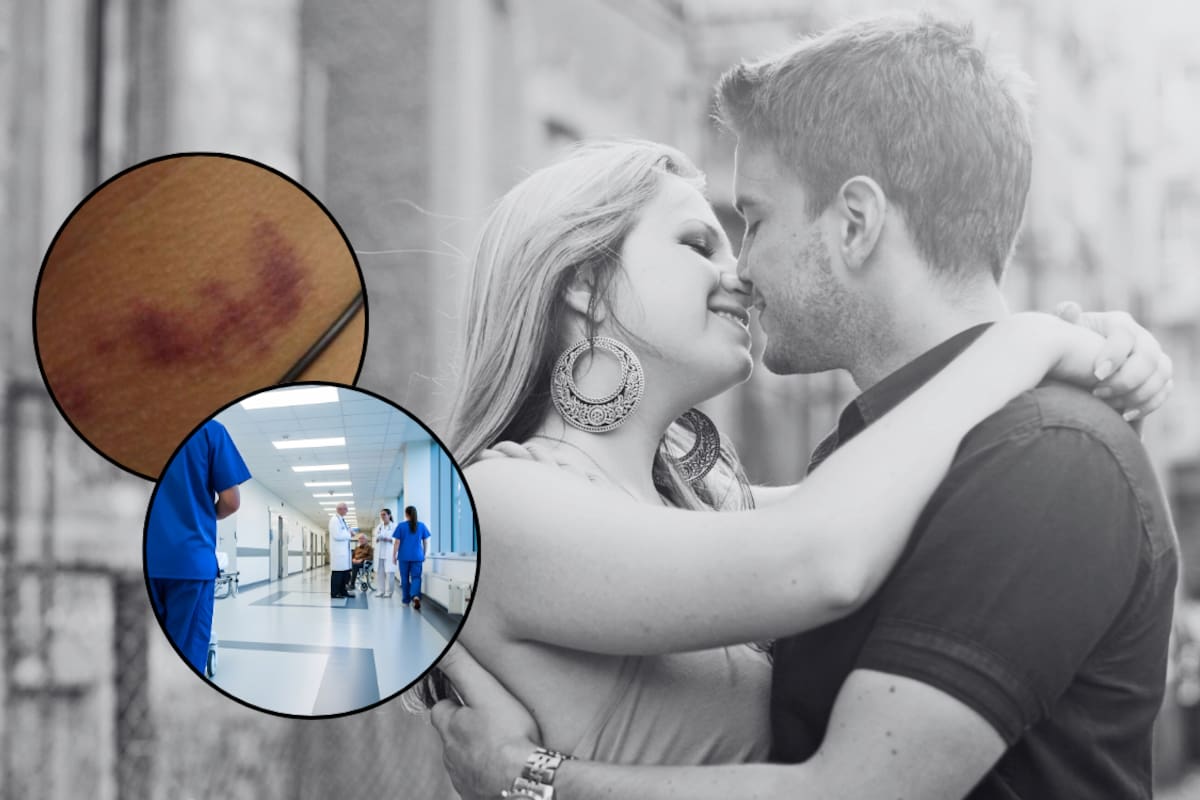 Adolescente muere tras recibir un “chupetón” en el cuello: qué se sabe del caso y cuáles son los riesgos de esta práctica