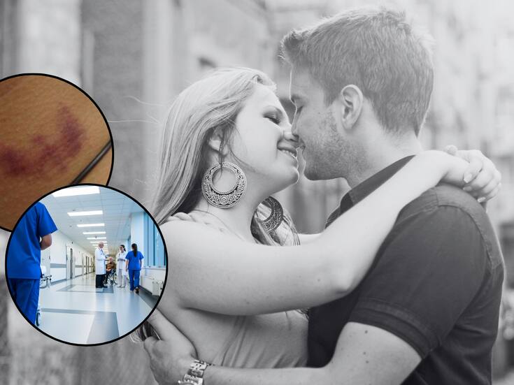 Adolescente muere tras recibir un “chupetón” en el cuello: qué se sabe del caso y cuáles son los riesgos de esta práctica