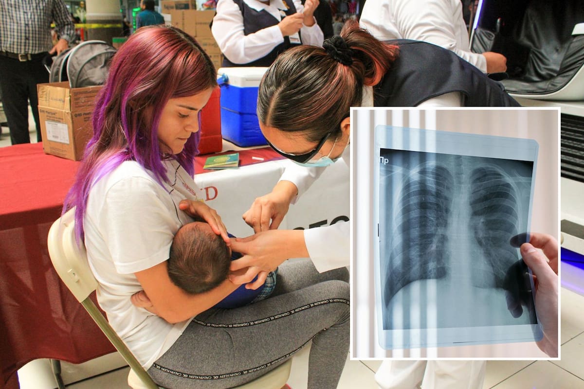 México registra alza de virus sincicial respiratorio, considerado el tercero más preocupante del invierno después de influenza y Covid