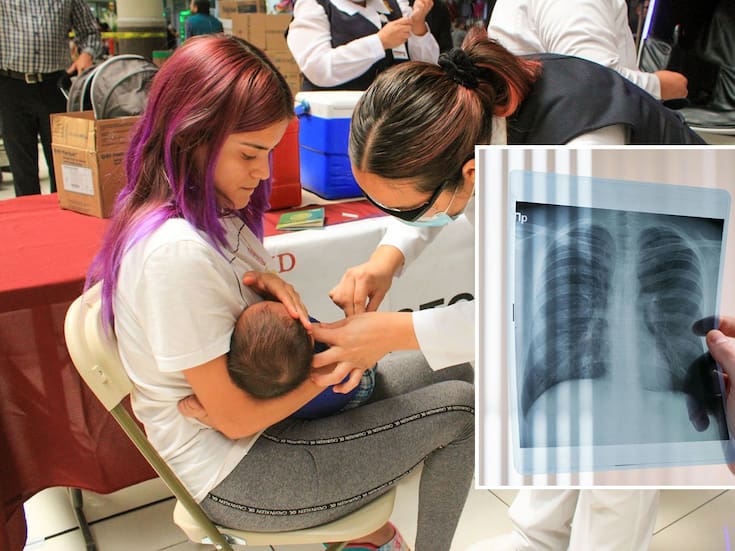 México registra alza de virus sincicial respiratorio, considerado el tercero más preocupante del invierno después de influenza y Covid