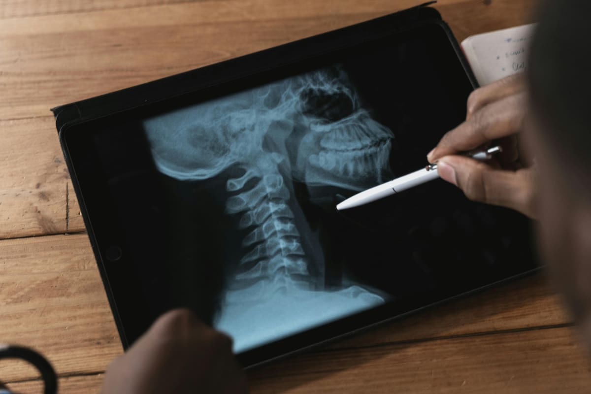 La RAE aclara: ¿Es correcto decir los cervicales o las cervicales?