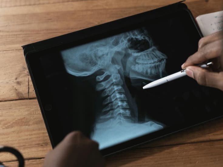 La RAE aclara: ¿Es correcto decir los cervicales o las cervicales?