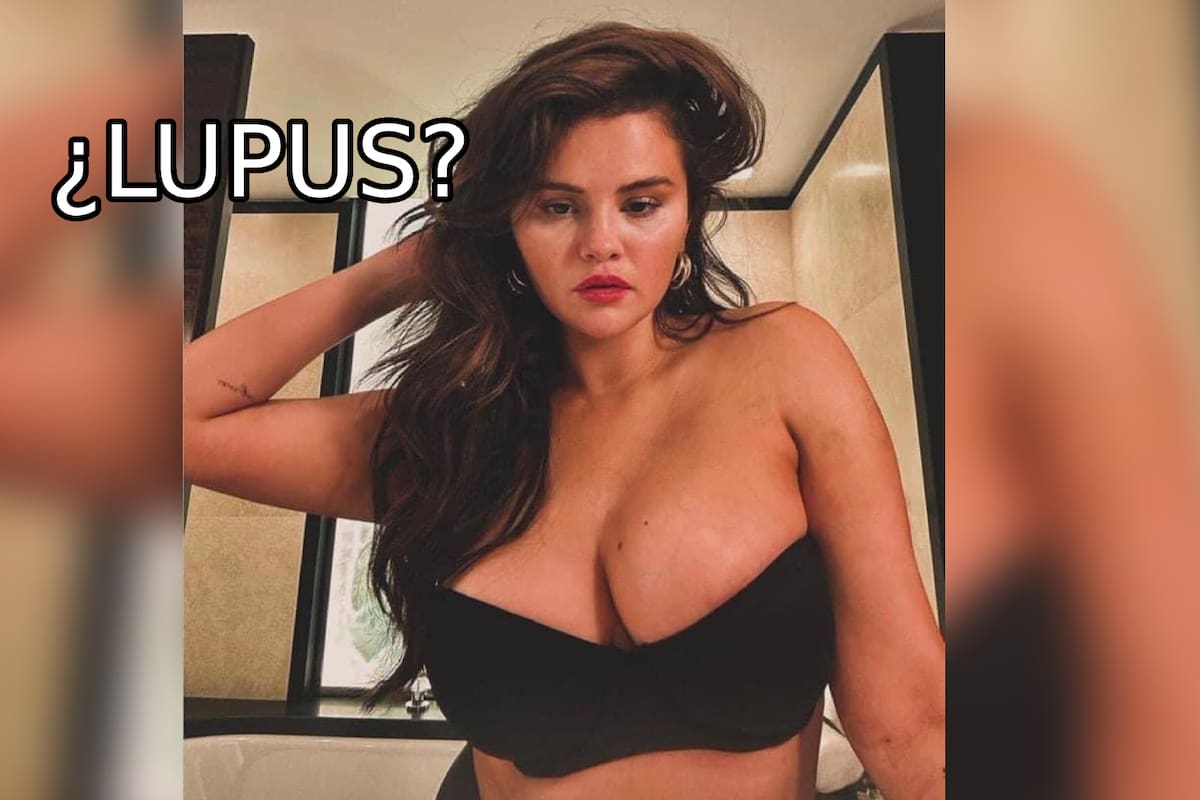 ¿Pechos de Selena Gomez se hincharon por el Lupus?