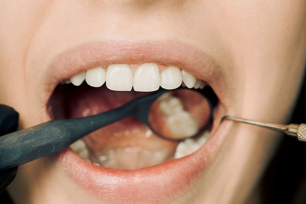 La dieta diaria, un factor clave en la salud bucal