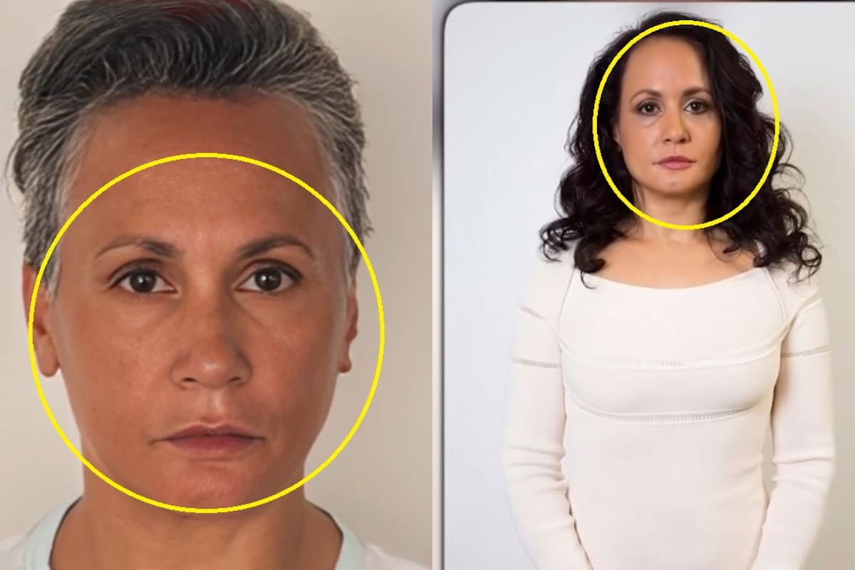 Mujer lleva más de 40 años sin sonreír porque asegura que así evita envejecer