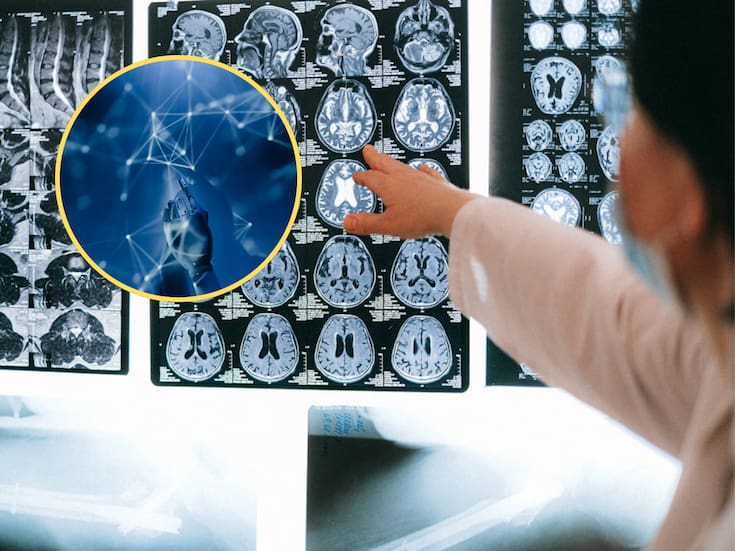 Uso excesivo de inteligencia artificial puede atrofiar el cerebro, alerta experta de la UNAM