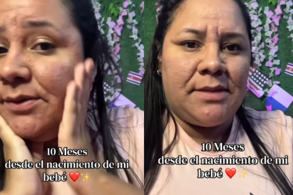 “Sufrió alergia gestacional”: joven de 27 años causa impacto en redes por su drástico cambio de apariencia