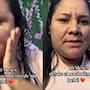 “Sufrió alergia gestacional”: joven de 27 años causa impacto en redes por su drástico cambio de apariencia