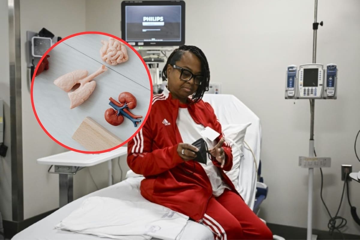 Mujer de Alabama vive 130 días con riñón de cerdo: Avances y desafíos en trasplantes de órganos animales