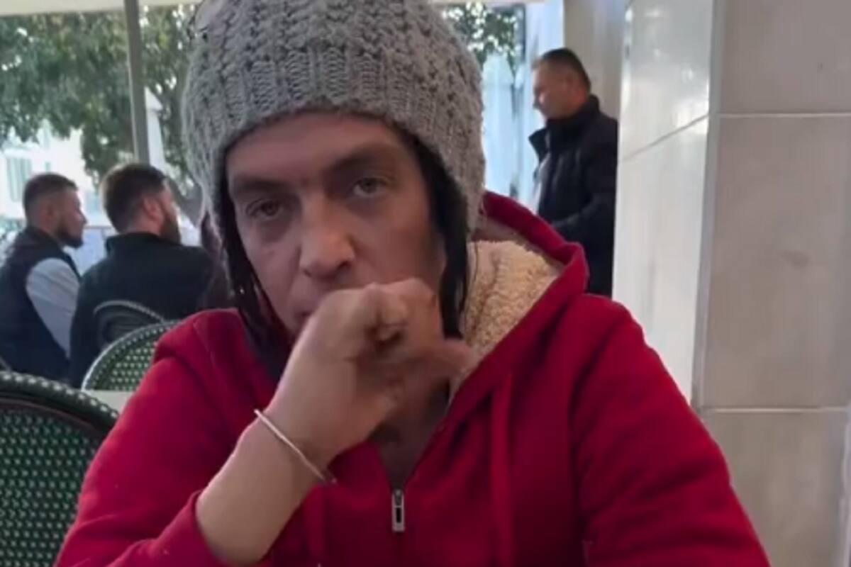 Camilo Blanes preocupa a fans por hinchazón en sus manos