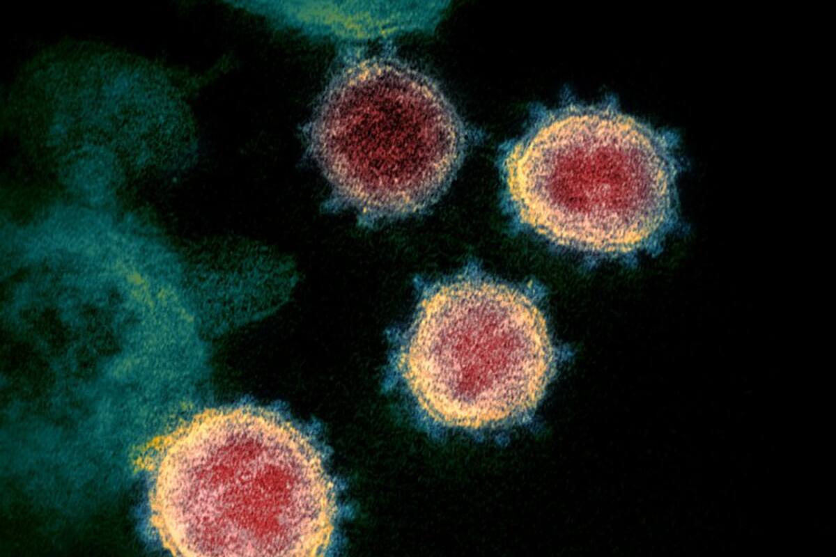 Científicos se muestran cautos a las pruebas rápidas de coronavirus