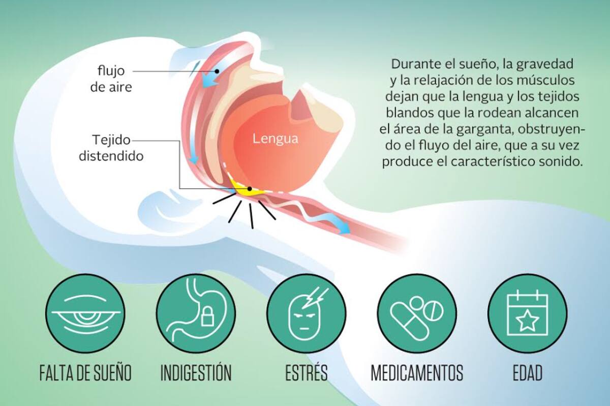 ¿Cómo se producen los ronquidos?
