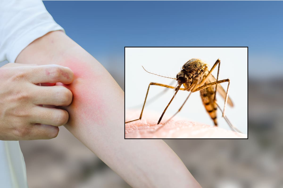 Superan los 400 casos de dengue en Cajeme